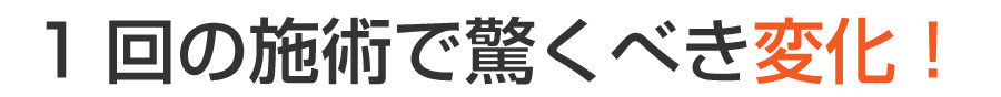 巻き爪フットケア目黒院,目黒 巻き爪,目黒 陥入爪